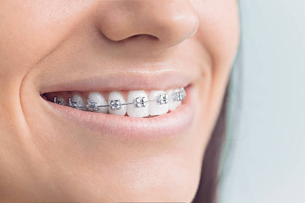 Full Mouth Reconstruction in Highspire, PA